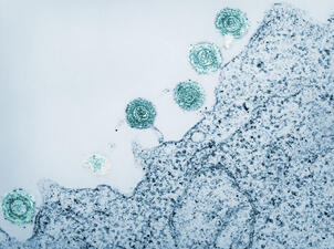 Electron micrograph of a human herpesvirus-6 virus shows 5 circular "eyes" on its surface.