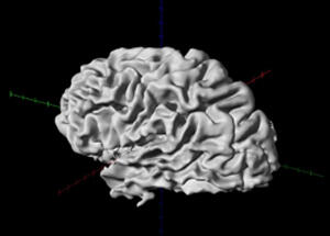 3D rendition of the human brain