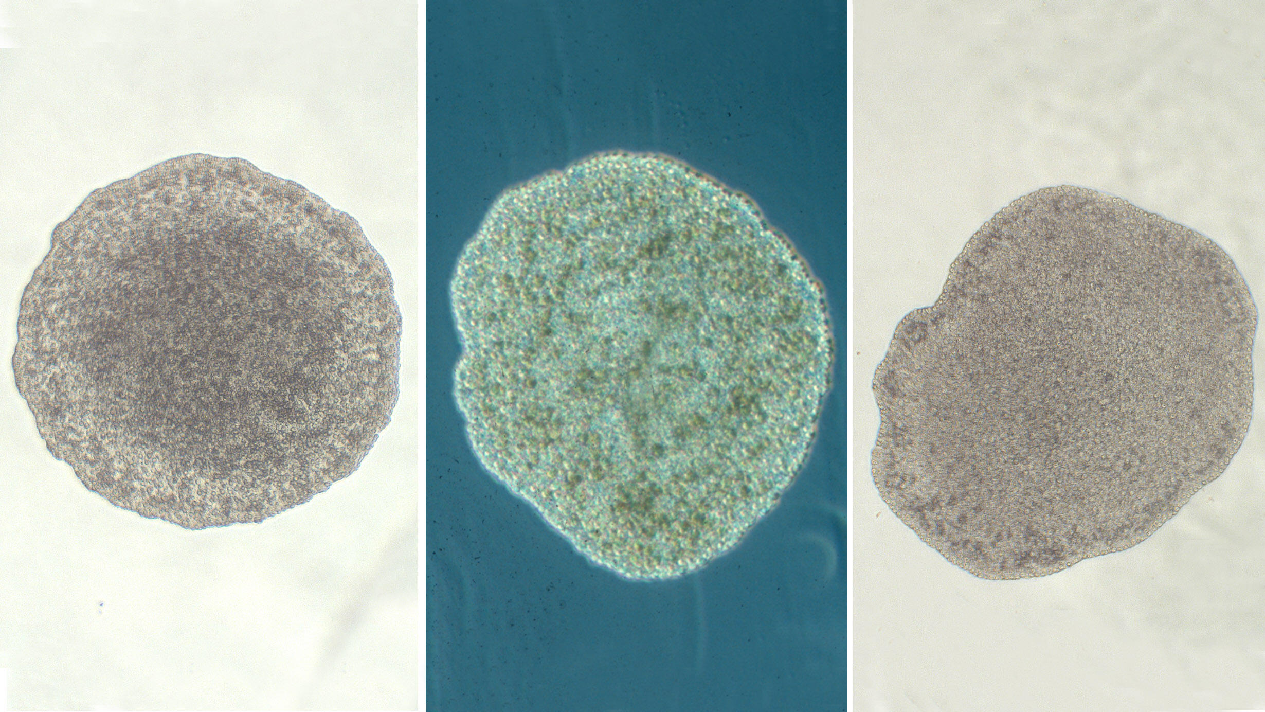 Three side-by-side placazoa specimens, each has a flat, circular shape.