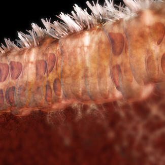 Microscopic image of skin showing skin cells and hairs