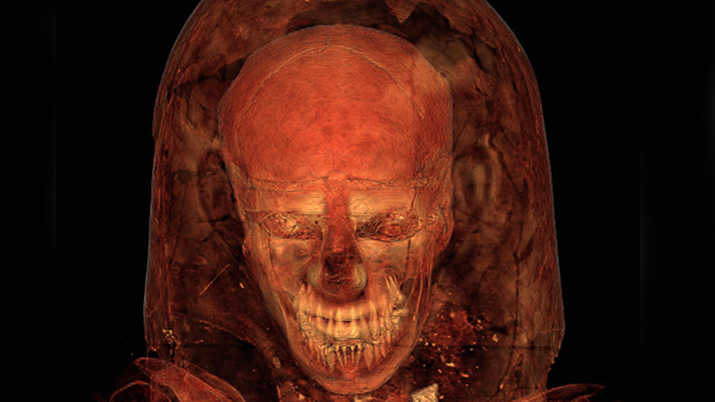 Scan reveals skull and also the outlines of tissue and hair. 