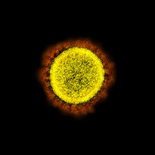Imagen microscópica de un solo virus SARS-CoV-2.