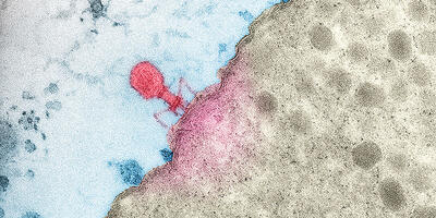  Vista microscópica de un bacteriófago.