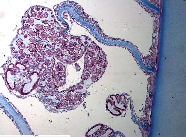 Stained cells visible on a microscope slide.