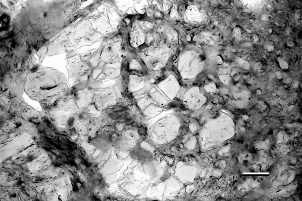 Photomicrograph of a thin section of theropod coprolite showing associated bone.