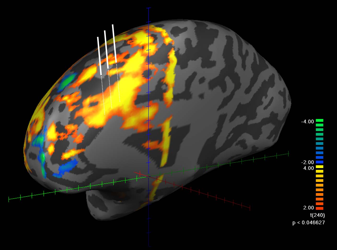 functional mri