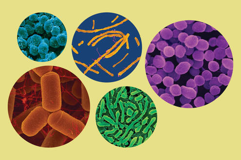 5 circles showing various types of Archaea: some are long, some round, and some pill-shaped.