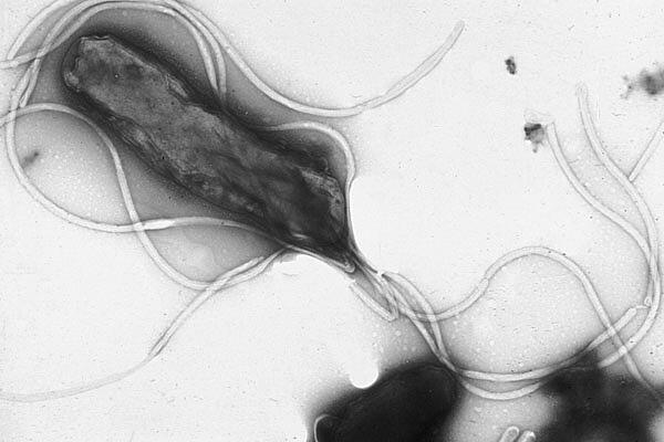 A Helicobacter pylori bacteria, a long oval shape with multiple long flagella, magnified through a microscope.