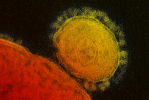 digitally colorized image of MERS-CoV