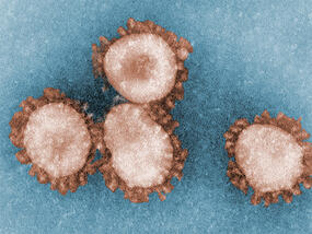 digitally colorized image depicting four human coronavirus