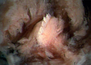 phillips_siddall_2010