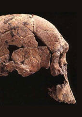 sackler_skull