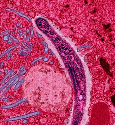 Microscopic view of malaria parasite, shown as a long, rounded figure. 