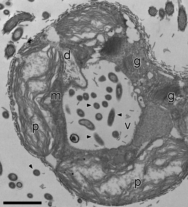 A black and white image of microorganisms on a slide. The superimposed letters d, g, v, p, and m, are distributed throughout.