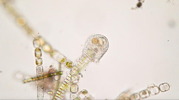 A microscope image showing green-tinted microorganisms. One round microbe engulfs the end of a long rectangular one.