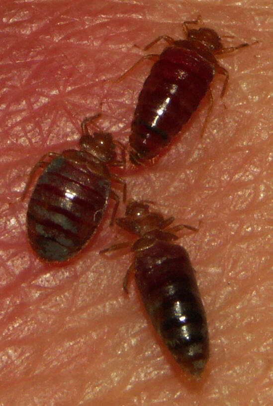 Bedbugs on skin