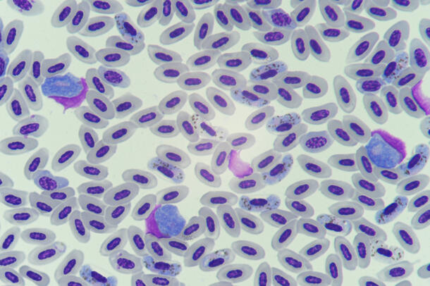 Nearly 100 purple-stained pill-shaped malaria parasites swarm across a white background