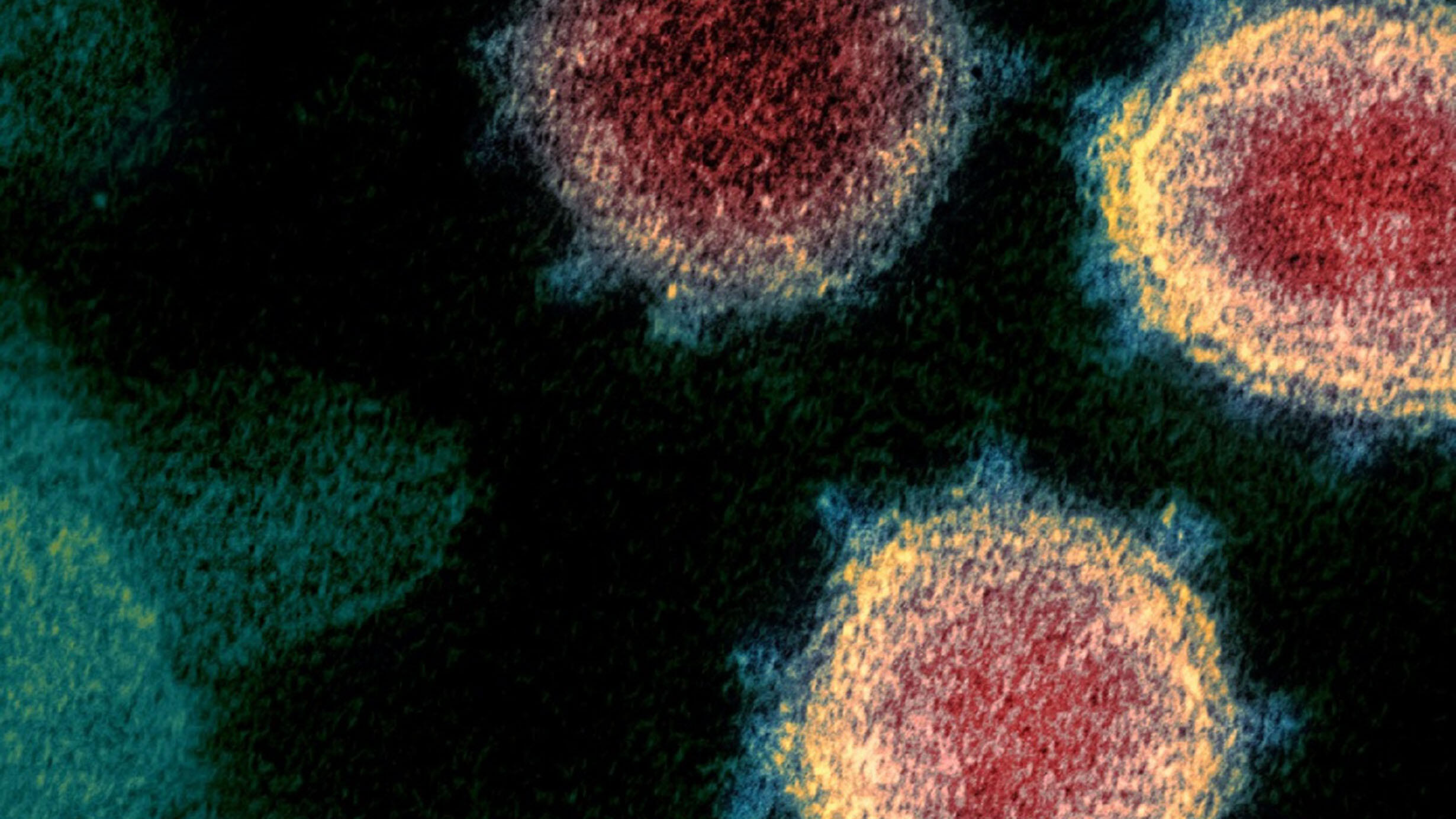 Magnified image of the SARS-CoV-2 virus, appearing as three two-toned irregular circles.