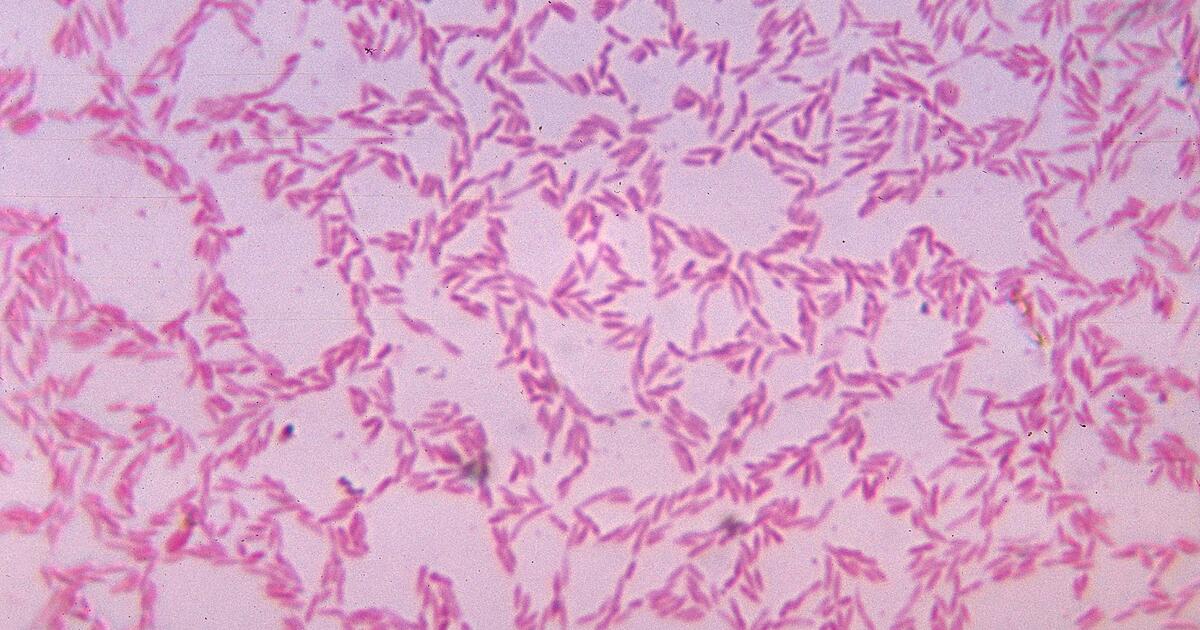 The Microbial Colony in Your Colon | AMNH
