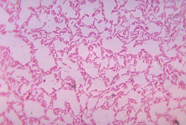 Microscopic close-up on bacteroides bacteria, visible as small, colorful ovals creating an inconsistent looping pattern.