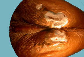 Close-up of the thick beak of an inflated-shaped Alasmidonta undulata triangle floater shell showing concentric markings.