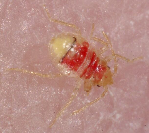 Close-up on a bed bug feeding on skin, translucent and filled with blood.