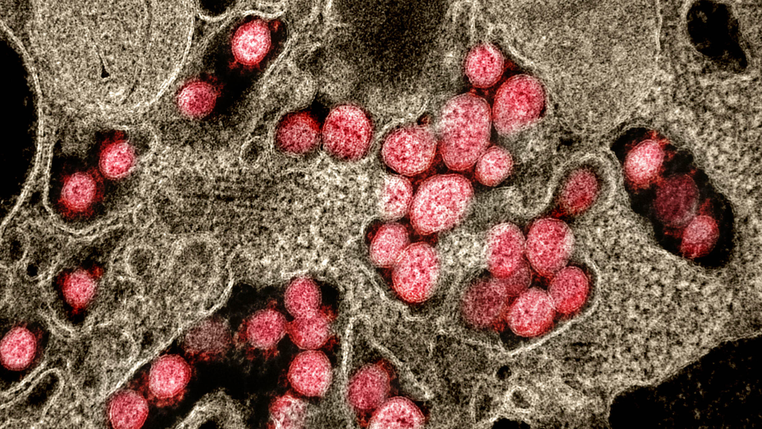 Dozens of round, spiked virus particles viewed within normal tissues.