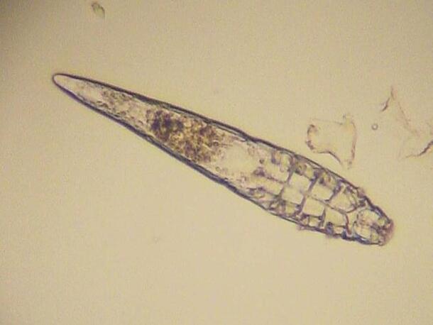 Magnified close-up on a long, oval follicle mite.