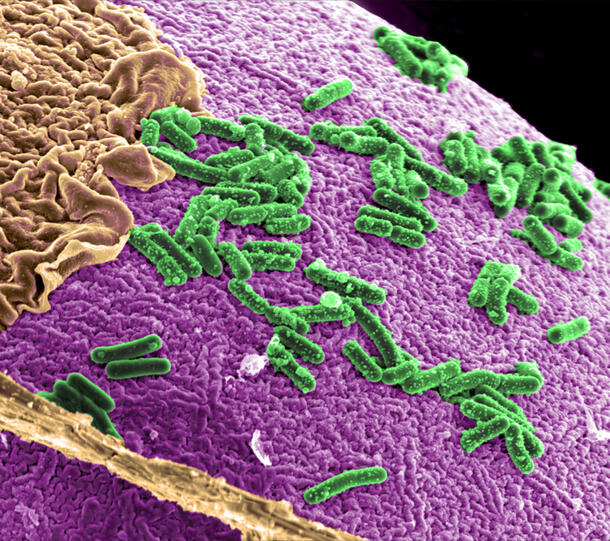 Gut Microbes 