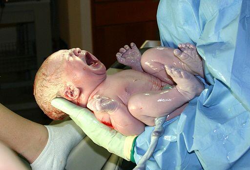 Human Newborn 