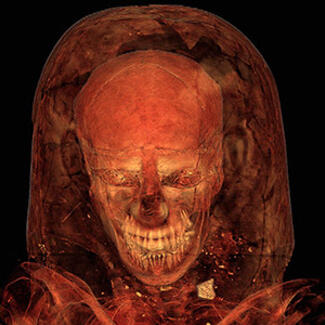 mummy ct scan