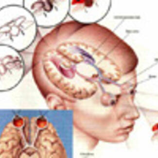 A drawing of a human head and face and a separate smaller drawing of a brain.