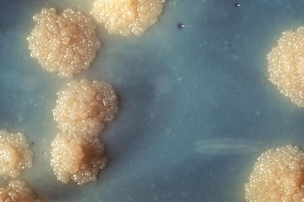 Clusters of Mycobacterium tuberculosis specimens.