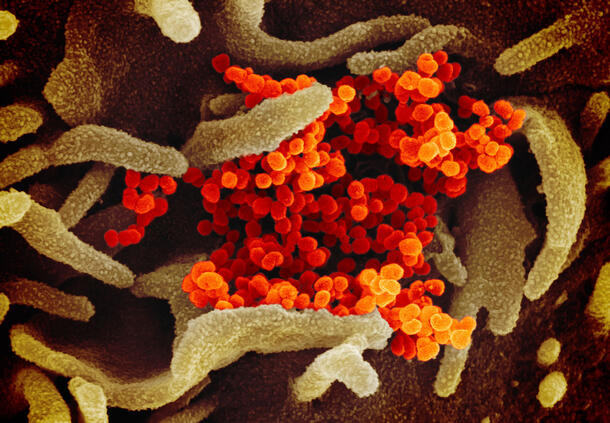 微小的球形病毒颗粒聚集在卷须状细胞表面的中间。