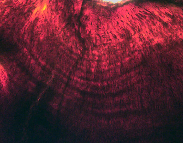 Microscopic view of the dentine growth lines, which visually resemble the rings of a tree.