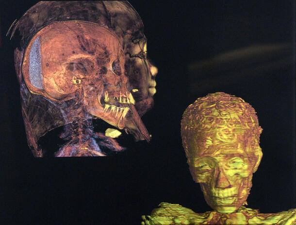 CT scans of the profile and frontal view of the Gilded Lady reveals the shape of her skill and face.