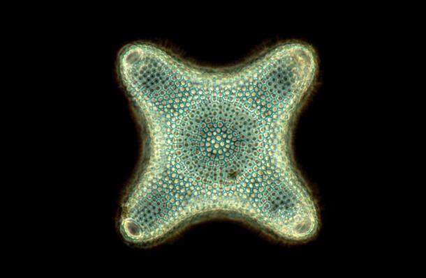 Diatom exhibits cell walls with a honey-combed appearance, and floats deep beneath the sea.
