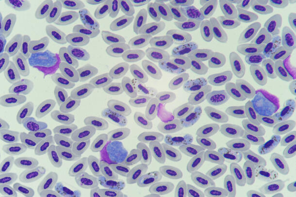 Microscopic view of malaria parasite.