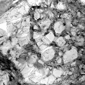 Photomicrograph of a thin section of theropod coprolite showing associated bone.