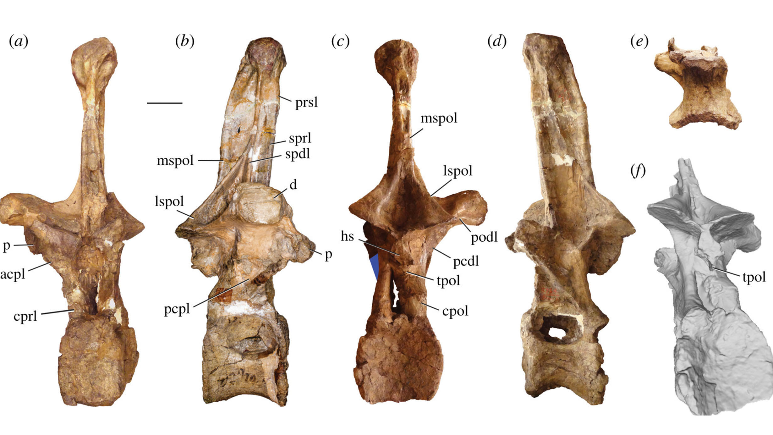 Five views of an Amphicoelias altus vertebra fossil.
