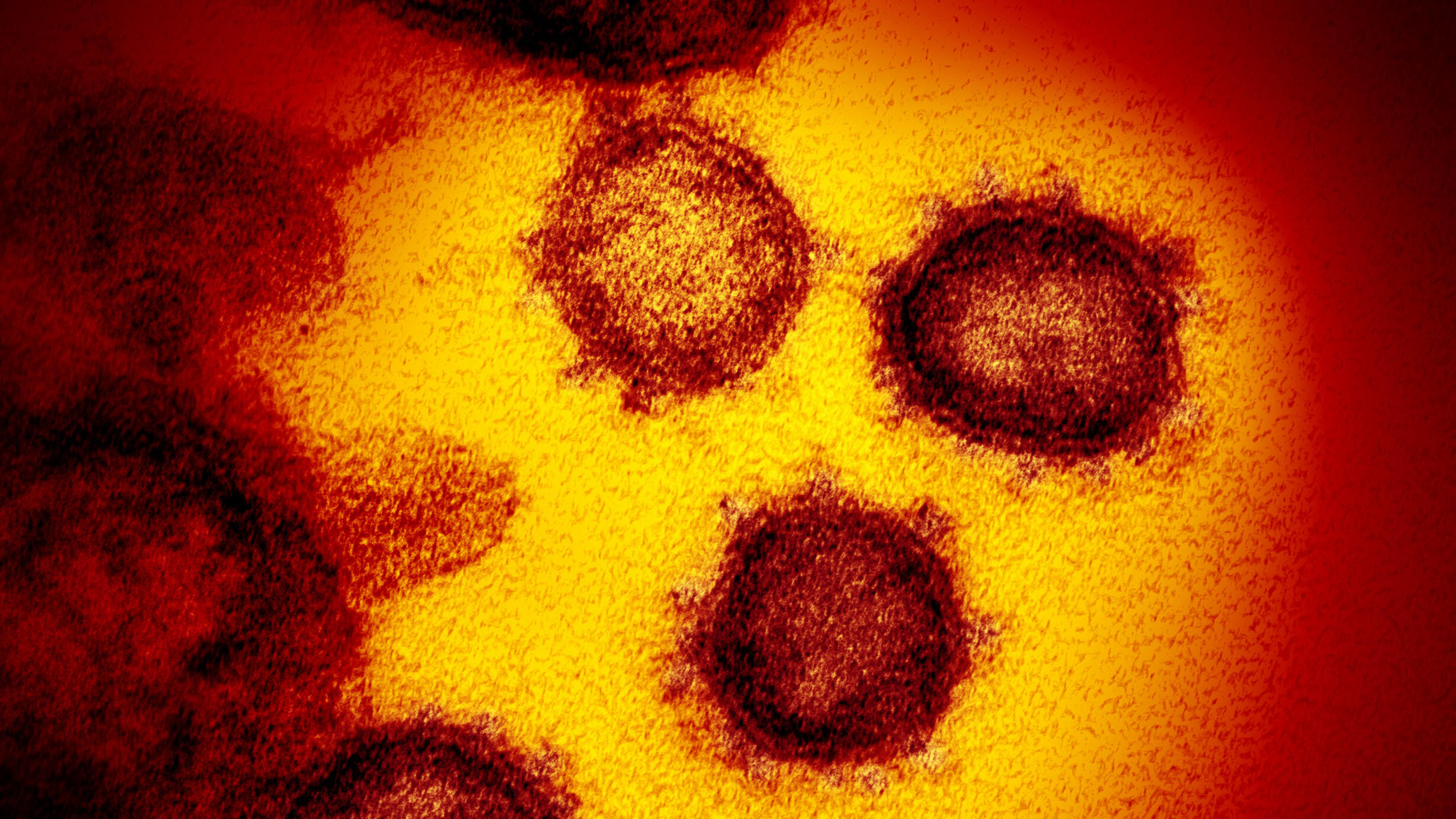 Magnified image of the SARS-CoV-2 virus, appearing as three colorful irregular circles surrounded by spikes.
