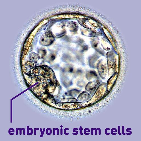 blastocyst with line pointing to embryonic stem cell cluster