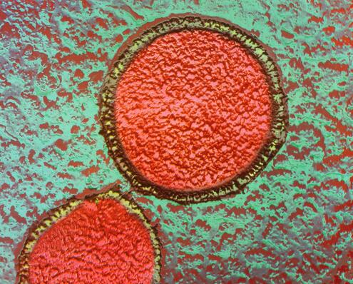 Two extreme microbes, both appearing round with a thin cell wall. 