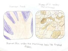 drawing of a human hand on the left and skin under the microscope on the right