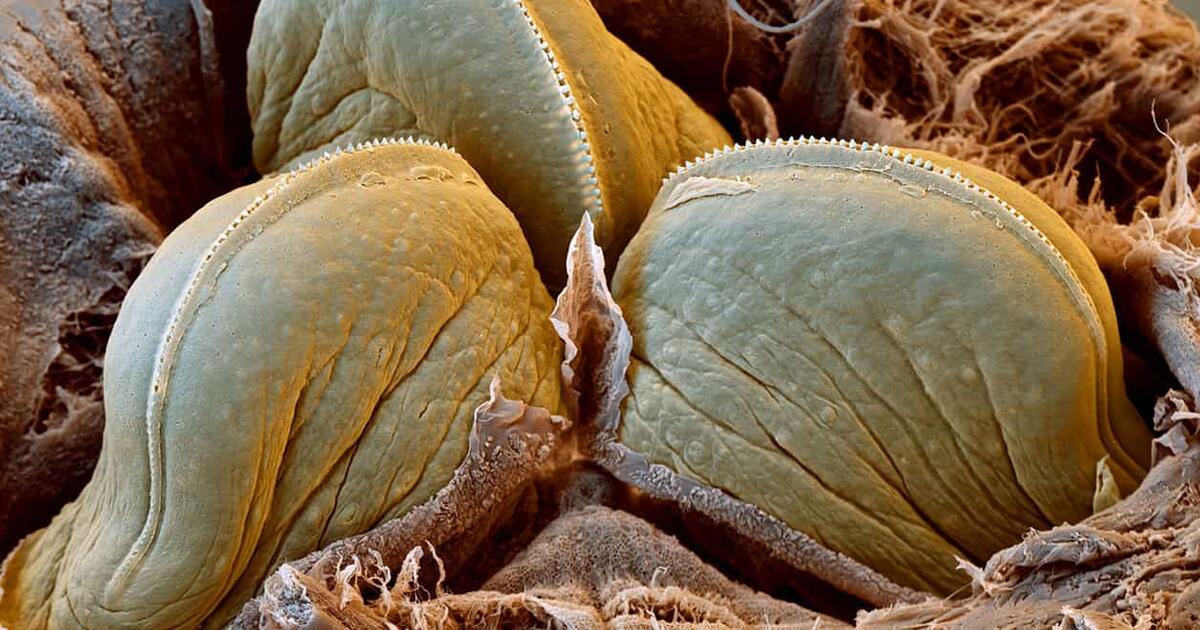 What's This? Leeches AMNH