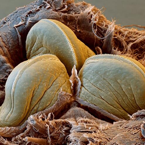 microscopic view leech