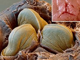 leech jaw close up and the shape of a leech bite on human skin
