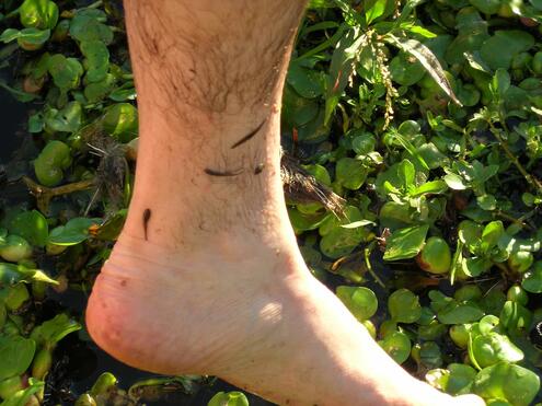 leeches on a person's ankle