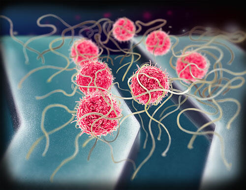 A rendering of seven bright cancer cells, depicted as spheres, covered in thin tentacles.