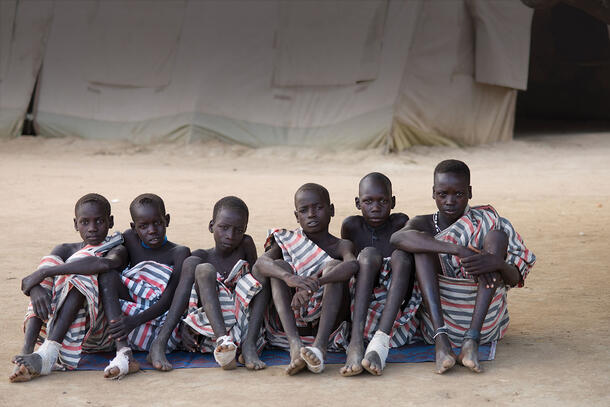 Six children with bandaged feet sit in a row on dirt in front of a tent.